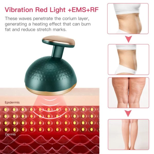 All-in-One Body Sculpting Device: EMS, RF, Heating, Vibration, Ultrasonic, and Tri-Color LED - Image 5