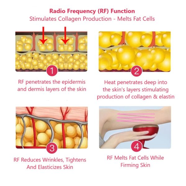 All-in-One Body Sculpting Device: EMS, RF, Heating, Vibration, Ultrasonic, and Tri-Color LED - Image 6