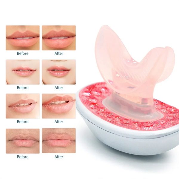 Anti-Aging Lip Plumper Device with Red Light Therapy | Anti-aging Lip Enhancer - Image 5